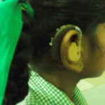 Albtal Hörgeräte Ettlingen spendet Hörgeräte für Herma aus Indien